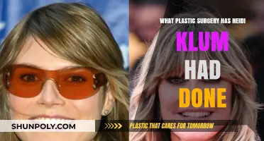 Heidi Klum's Plastic Surgery: Unveiling Her Transformation and Procedures