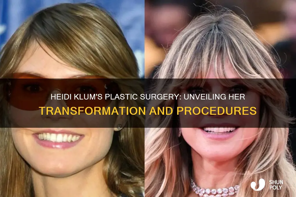 what plastic surgery has heidi klum had done