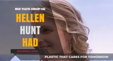 Helen Hunt's Plastic Surgery: Rumors, Facts, and Transformation Explored