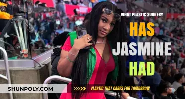 Jasmine's Plastic Surgery Journey: Procedures, Results, and Transformation Revealed