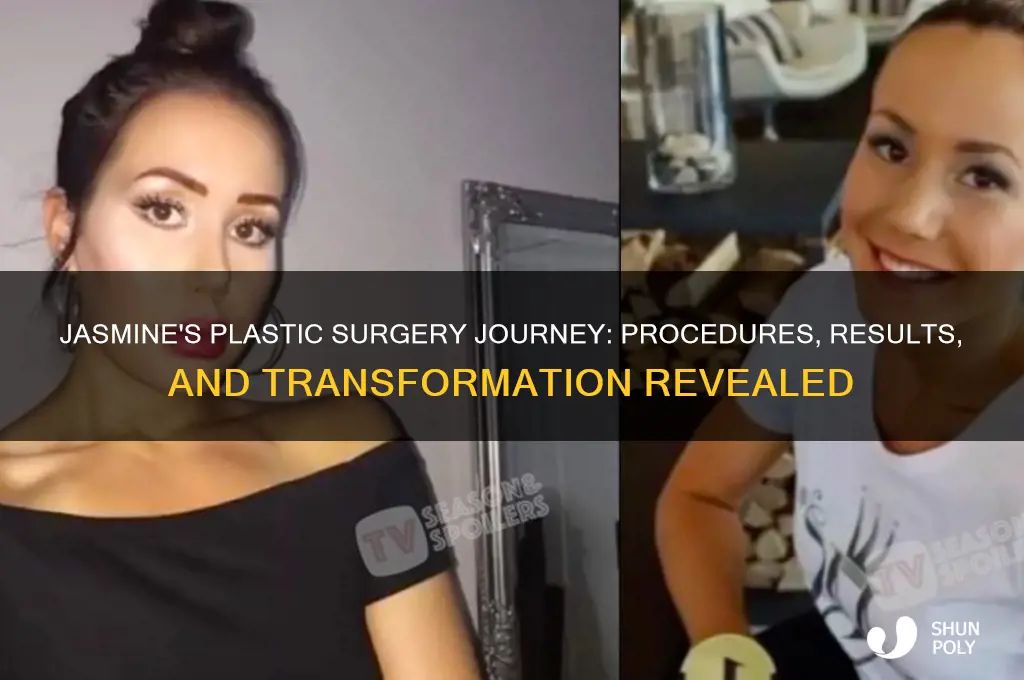 what plastic surgery has jasmine had