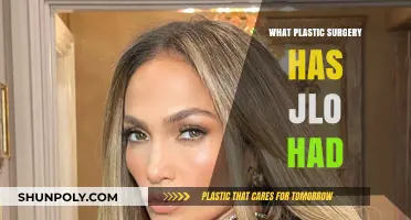 JLo's Transformation: Unveiling Her Plastic Surgery Journey and Secrets
