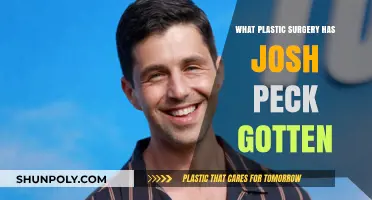 Josh Peck's Plastic Surgery Transformation: Rumors and Realities Explored