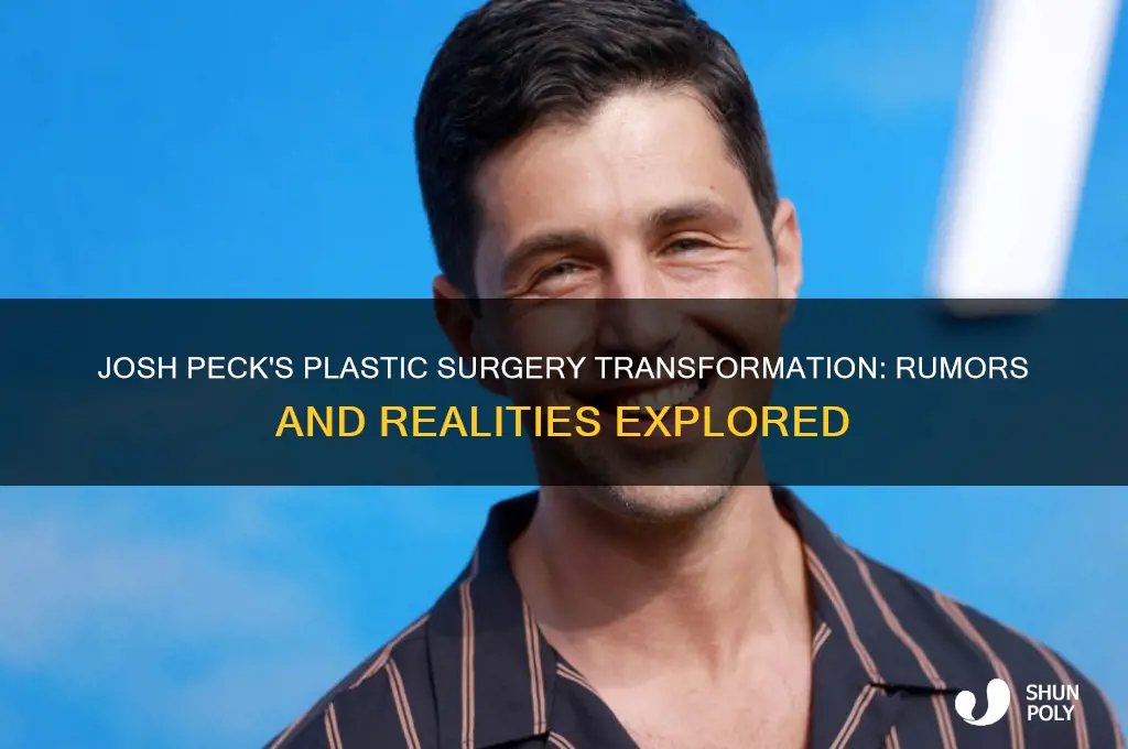 what plastic surgery has josh peck gotten