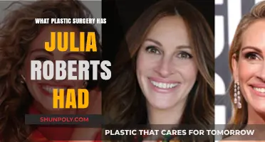 Julia Roberts' Plastic Surgery: Rumors, Facts, and Her Natural Beauty