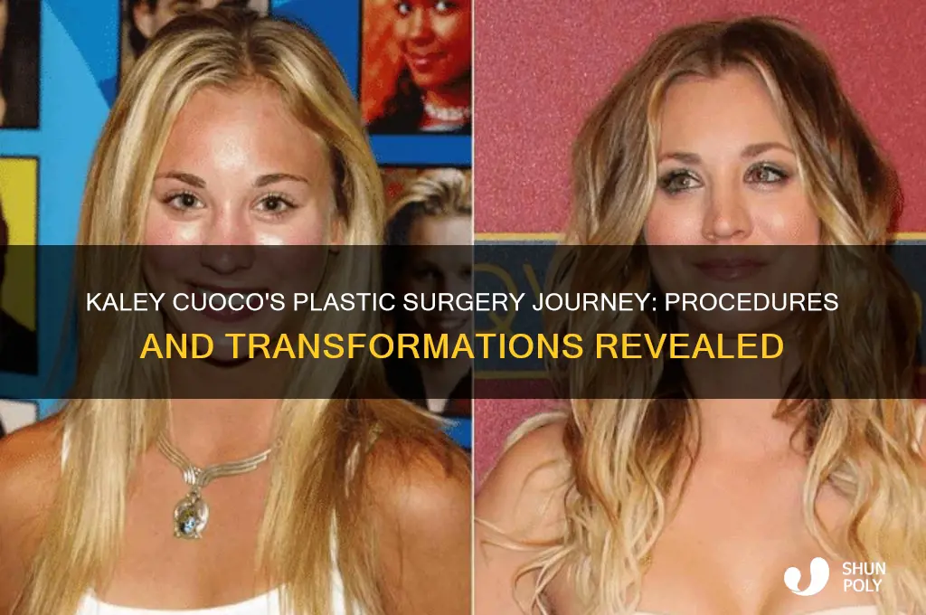 what plastic surgery has kaley cuoco had