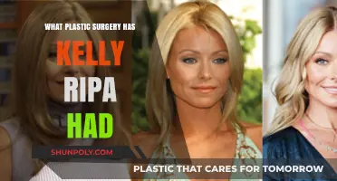 Kelly Ripa's Plastic Surgery: Rumors, Facts, and Transformation Revealed