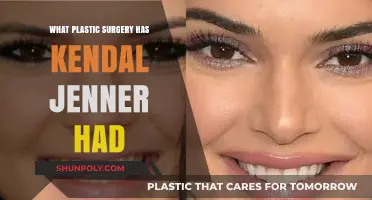 Kendall Jenner's Plastic Surgery Speculations: Fact-Checking Her Transformation