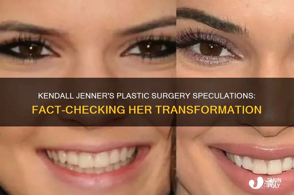 what plastic surgery has kendal jenner had