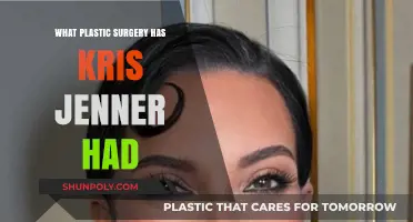 Kris Jenner's Plastic Surgery Journey: Rumors, Facts, and Transformations