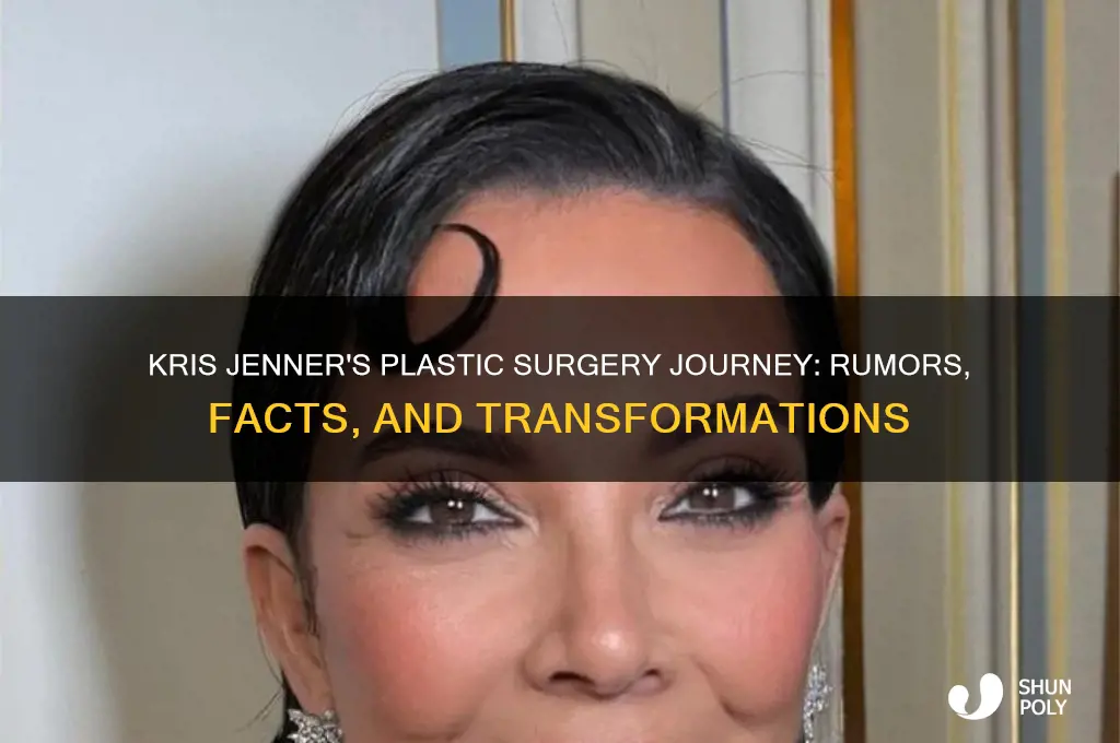 what plastic surgery has kris jenner had