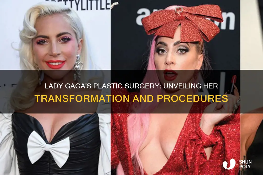what plastic surgery has lady gaga had