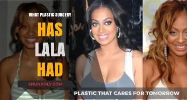 Lala's Plastic Surgery Journey: Procedures, Results, and Transformation Revealed
