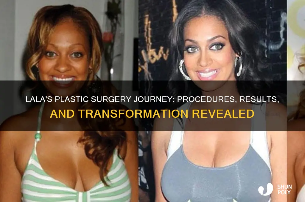 what plastic surgery has lala had