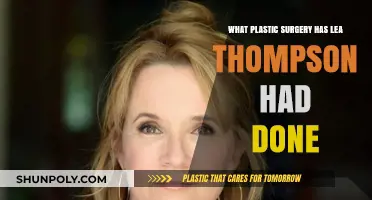 Lea Thompson's Plastic Surgery: Rumors, Facts, and Transformations Revealed