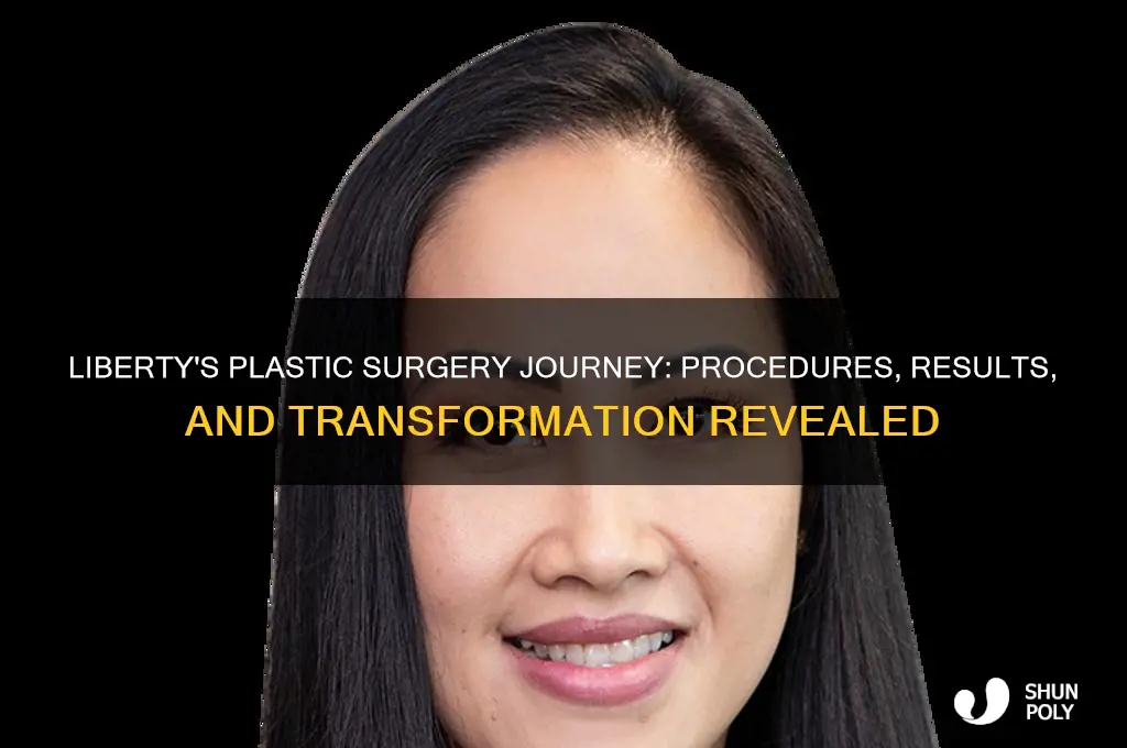 what plastic surgery has liberty had
