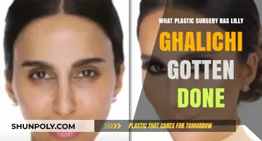 Lilly Ghalichi's Plastic Surgery Journey: Procedures and Transformations Revealed