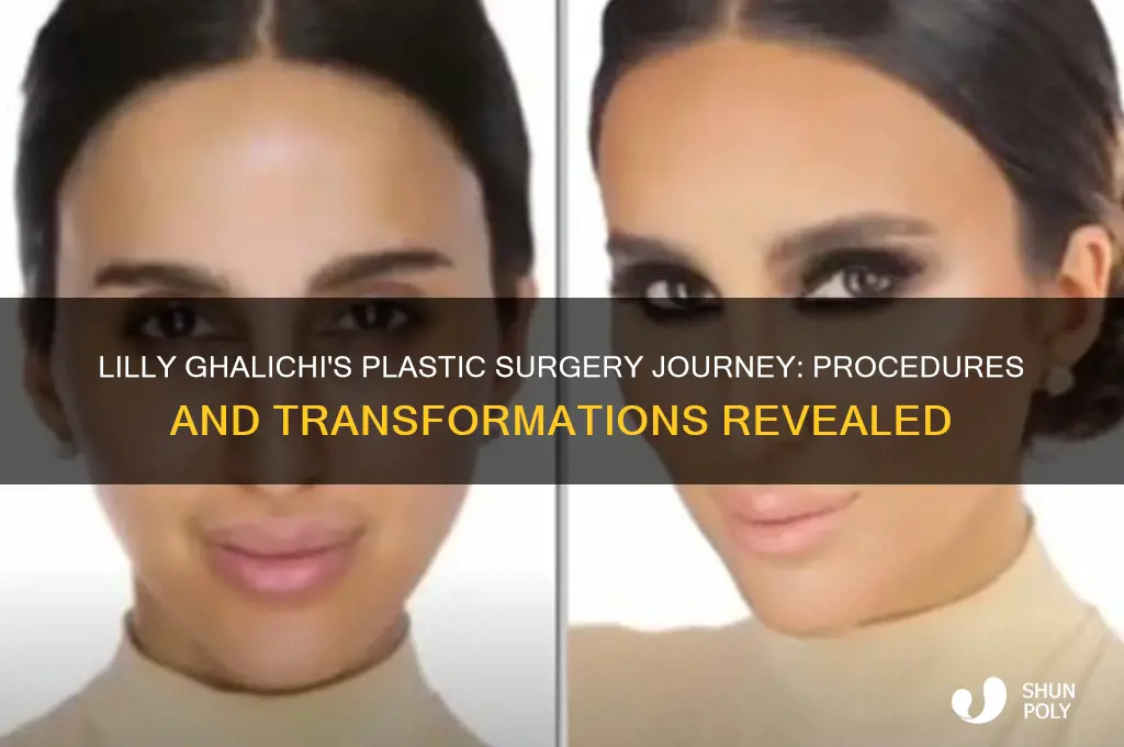 what plastic surgery has lilly ghalichi gotten done