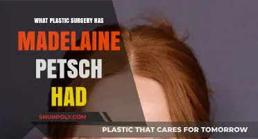 Madelaine Petsch's Plastic Surgery: Rumors, Facts, and Transformation