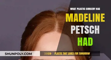 Madeline Petsch's Plastic Surgery: Rumors, Facts, and Transformation