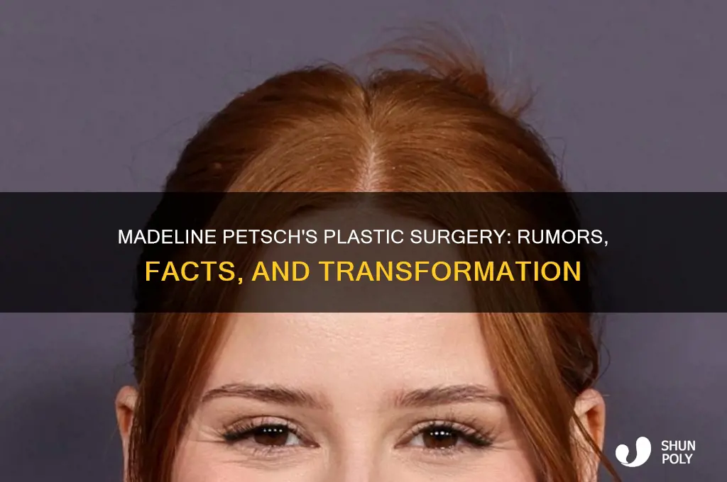 what plastic surgery has madeline petsch had