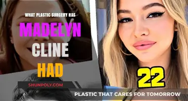 Madelyn Cline's Plastic Surgery: Unveiling Her Transformation and Speculations