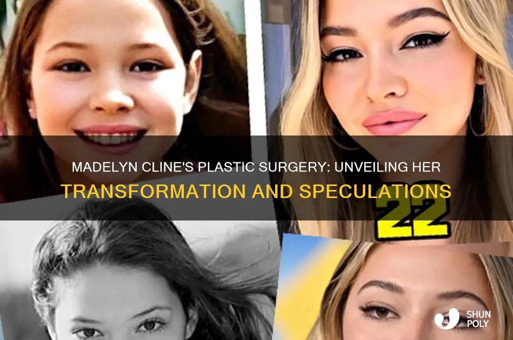 what plastic surgery has madelyn cline had