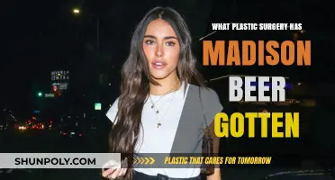 Madison Beer's Plastic Surgery: Rumors, Facts, and Transformations Revealed