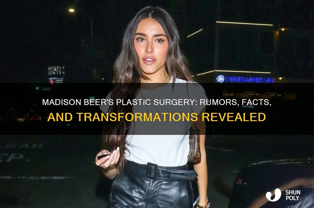 what plastic surgery has madison beer gotten