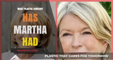 Martha's Plastic Surgery Journey: Procedures, Results, and Transformation Revealed