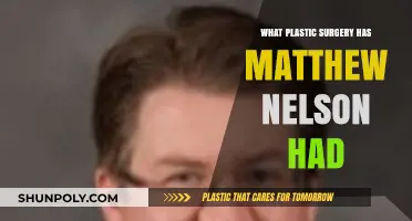 Matthew Nelson's Plastic Surgery: Rumors, Facts, and Transformations Revealed