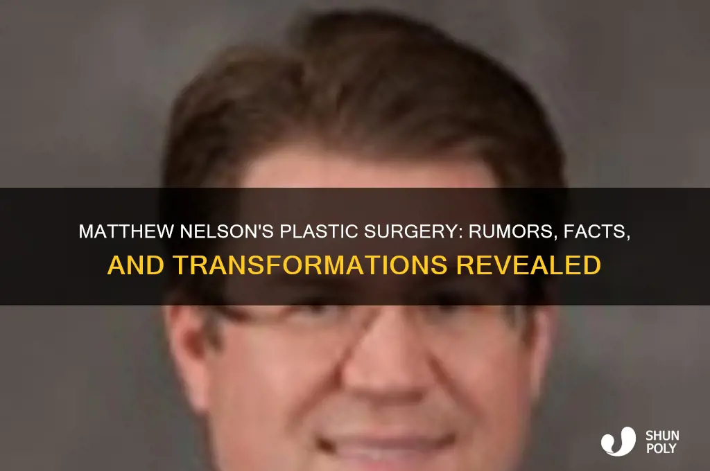 what plastic surgery has matthew nelson had