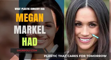 Megan Markle's Plastic Surgery: Rumors, Facts, and Transformations Explored