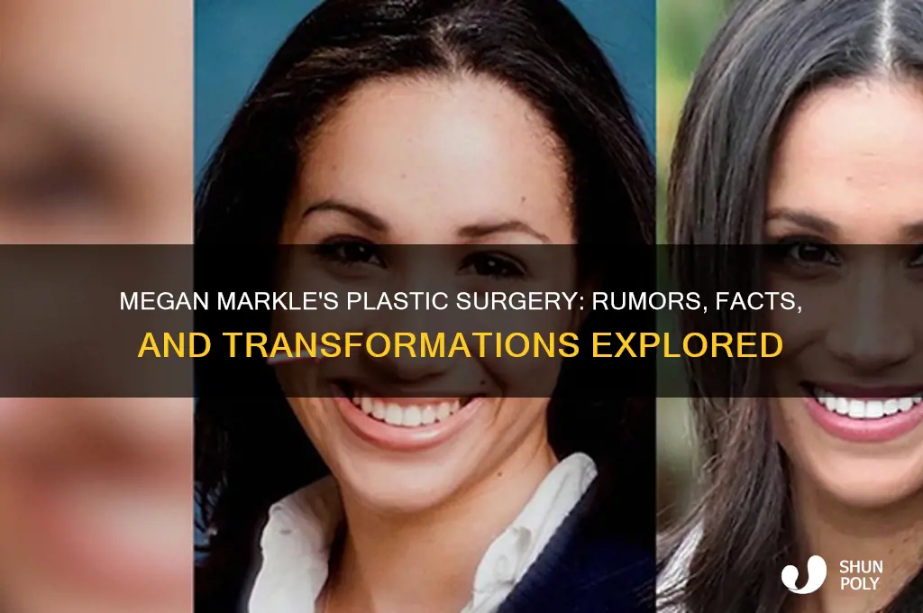 what plastic surgery has megan markel had