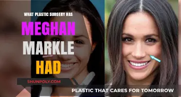 Meghan Markle's Plastic Surgery Speculations: Fact-Checking the Rumors