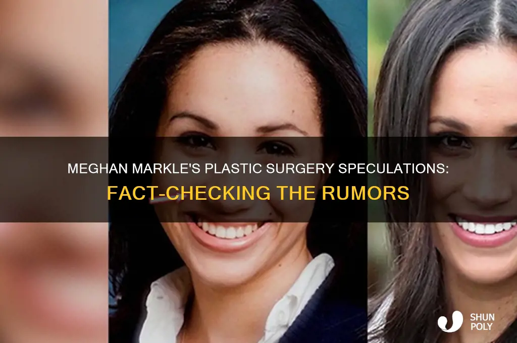 what plastic surgery has meghan markle had