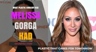 Melissa Gorga's Plastic Surgery Journey: Procedures and Transformations Revealed