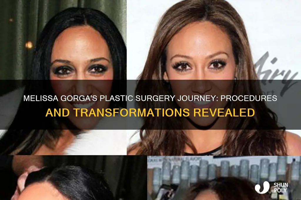 what plastic surgery has melissa gorga had