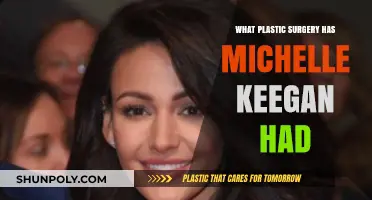 Michelle Keegan's Plastic Surgery: Rumors, Facts, and Transformation Journey