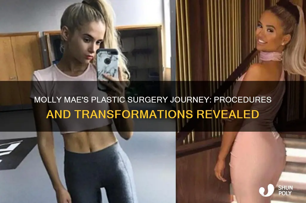 what plastic surgery has molly mae had