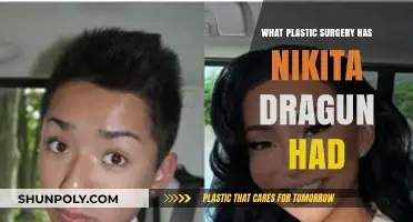 Nikita Dragun's Plastic Surgery Journey: Procedures and Transformations Revealed