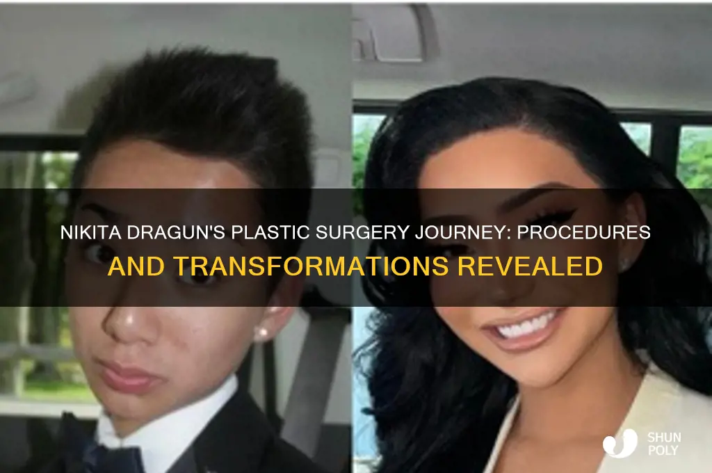 what plastic surgery has nikita dragun had