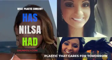 Nilsa's Plastic Surgery Journey: Procedures, Results, and Transformation Revealed