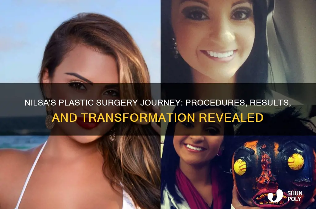 what plastic surgery has nilsa had