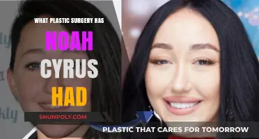 Noah Cyrus' Plastic Surgery Journey: Procedures and Transformations Revealed