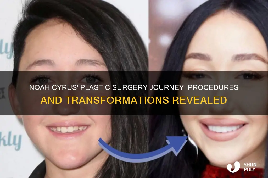 what plastic surgery has noah cyrus had