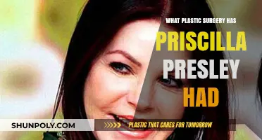Priscilla Presley's Plastic Surgery Journey: Procedures and Transformations Revealed