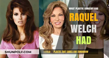 Raquel Welch's Plastic Surgery Journey: Rumors, Facts, and Transformations