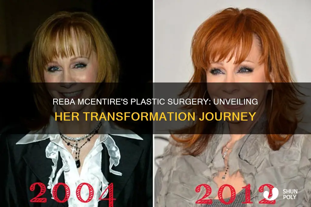 what plastic surgery has reba mcentire had