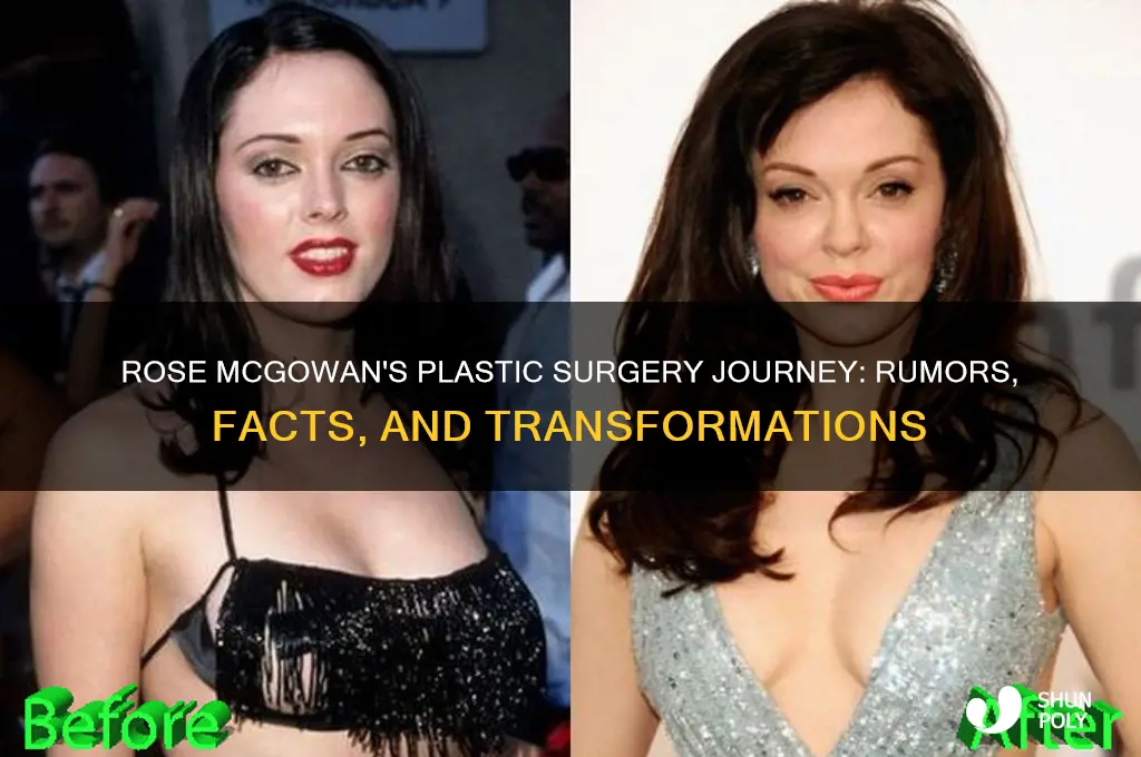 what plastic surgery has rose mcgowan had